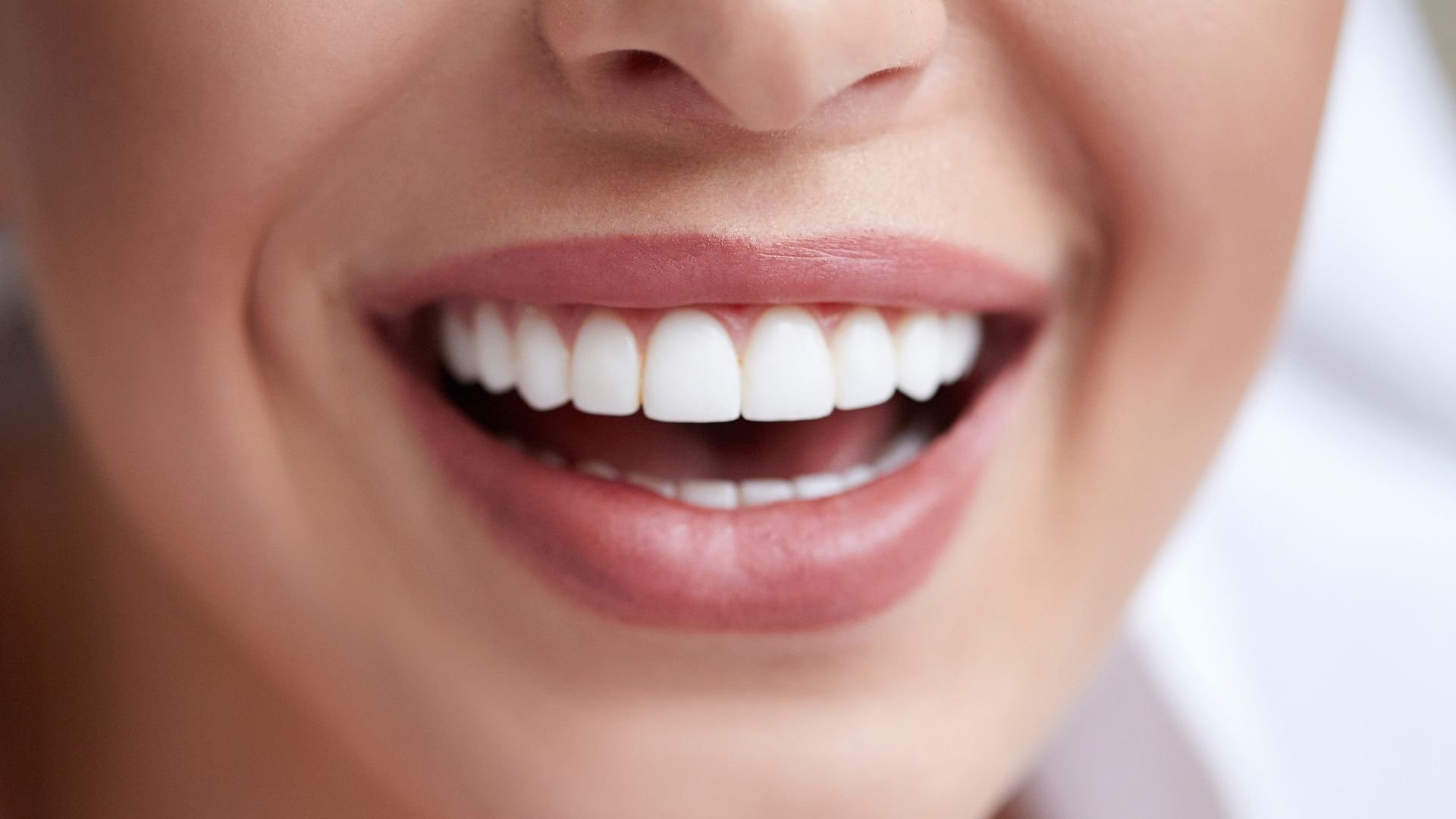 Myth #1: Porcelain Veneers Look Fake